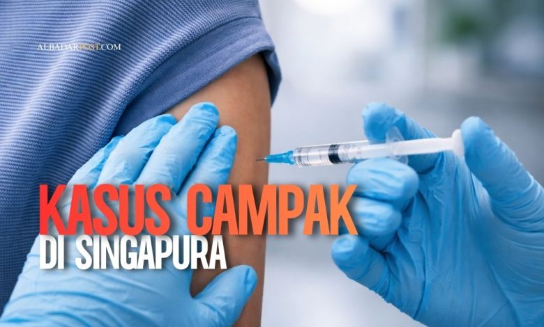 Petugas kesehatan Singapura menangani peningkatan kes campak dengan kebijakan pengasingan wajib dan pengesanan kontak