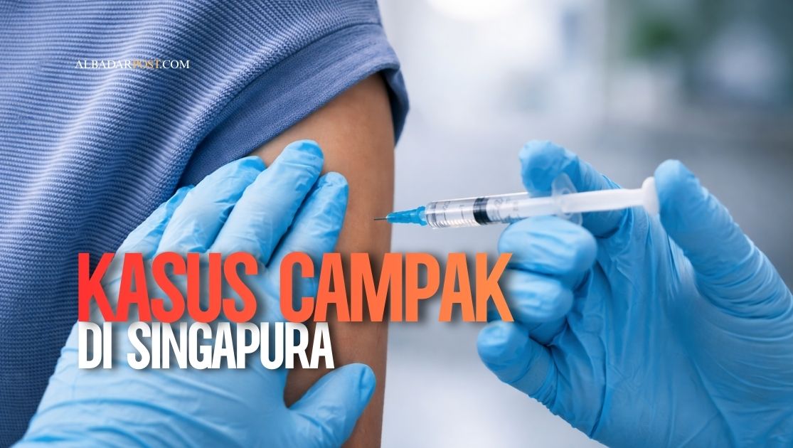 Petugas kesehatan Singapura menangani peningkatan kes campak dengan kebijakan pengasingan wajib dan pengesanan kontak